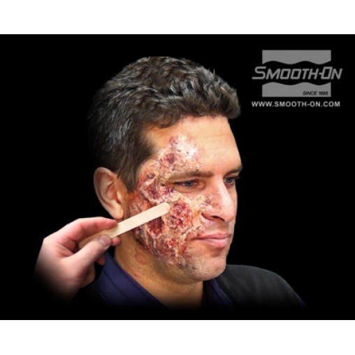 Skin Tite Ultimate Wound Kit Skin Tite Ultimate Wound Kit