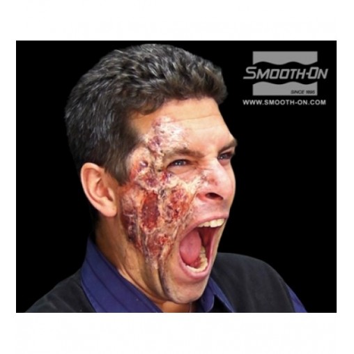 Skin Tite Ultimate Wound Kit Skin Tite Ultimate Wound Kit